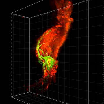 An scientific figure showing three-dimensional vascular imaging