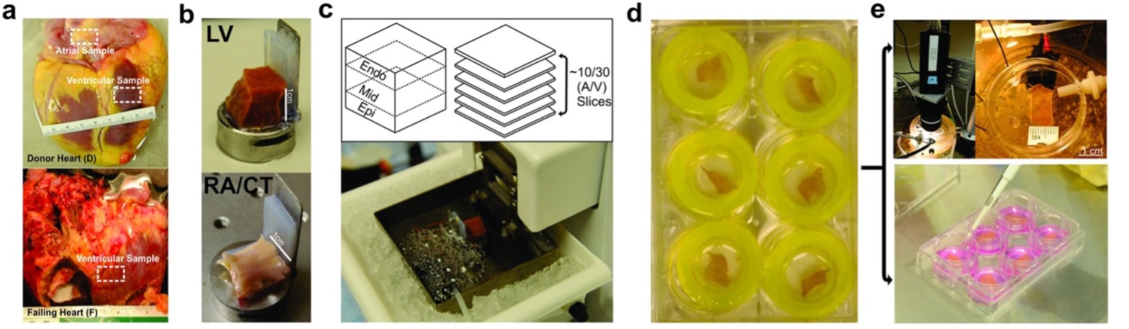 A scientific figure showing human cardiac slice methodology.