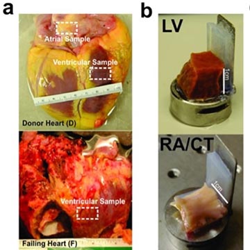Human atrial and ventricular tissue from donor and diseased hearts