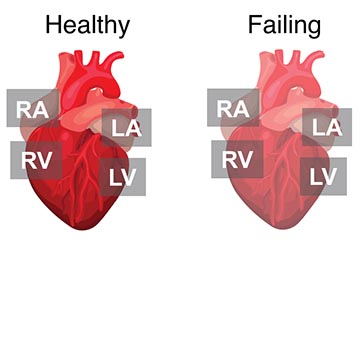 Cartoon illustrations depicting healthy and failing human hearts