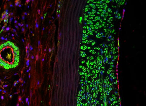 A tissue-engineered vascular graft