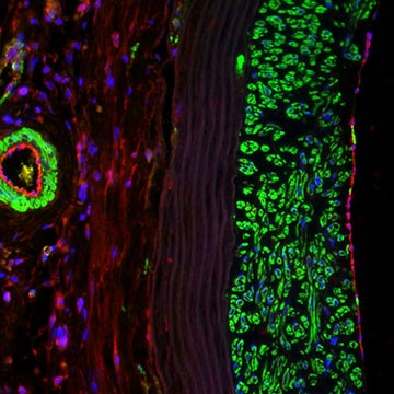 A bright microscopic image of a vascular graft