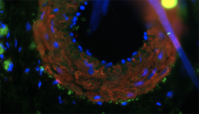 A micrograph of an engineered artery