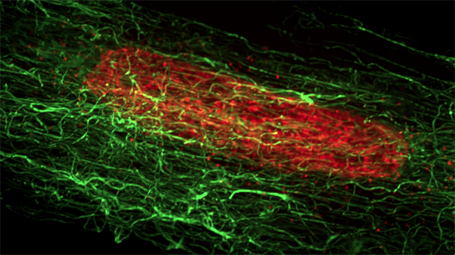     Image shows microtubule structure (green) in an adult cardiomyocyte. Red: nucleus. 
