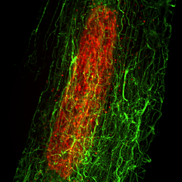 An image showing microtubule structure (green) in an adult cardiomyocyte (nucleus shown in red).