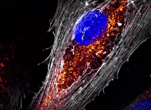 Engineered human stem cell-derived mitochondria (red) taken up by diabetic endothelial cells.