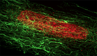 Microtubule structure (green) in a heart cell, with nucleus shown in red.